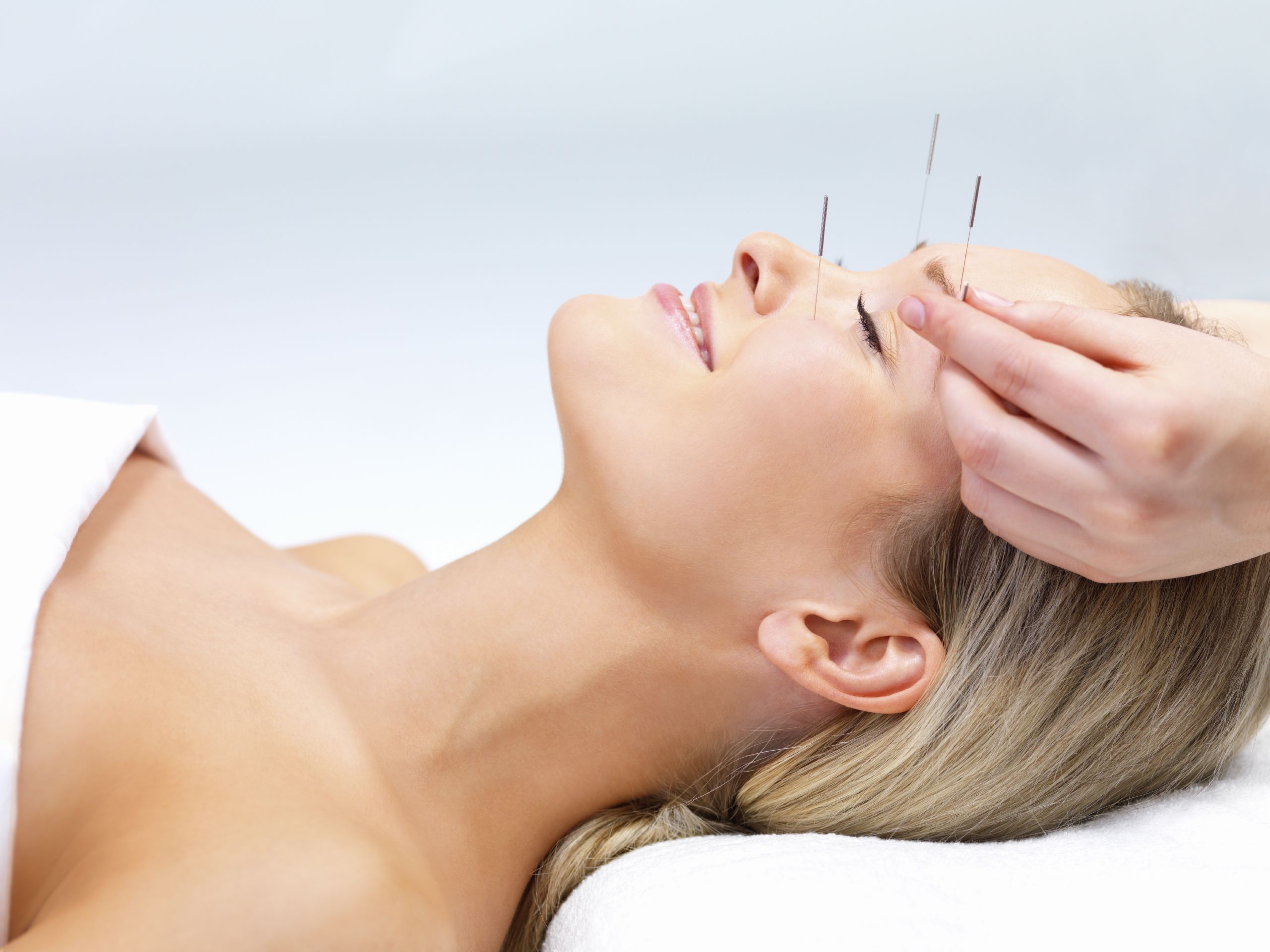 Acupuncture therapy - alternative medicine.