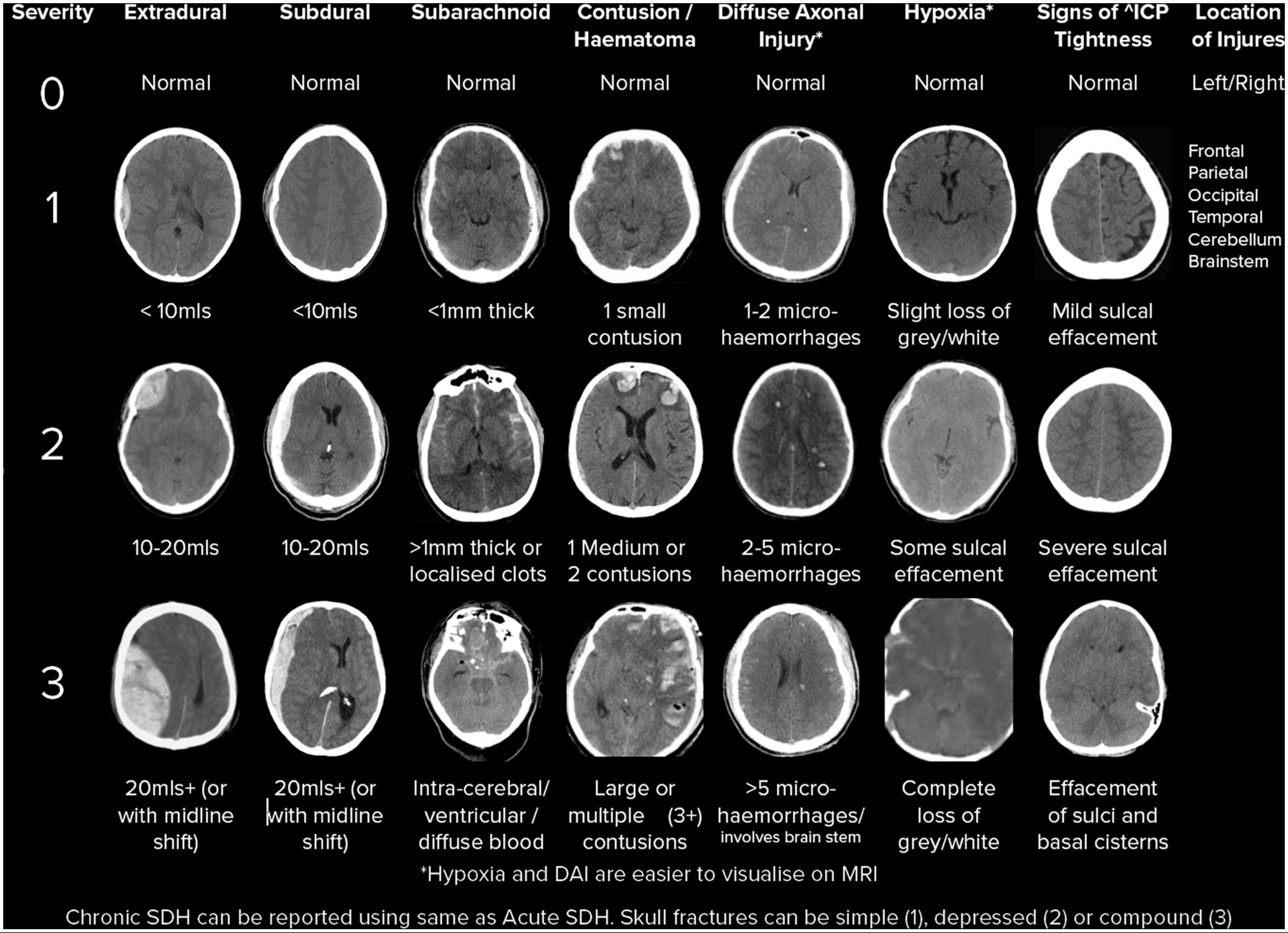 TBI severity CT reference chart from the 2026 nurse disbelief post